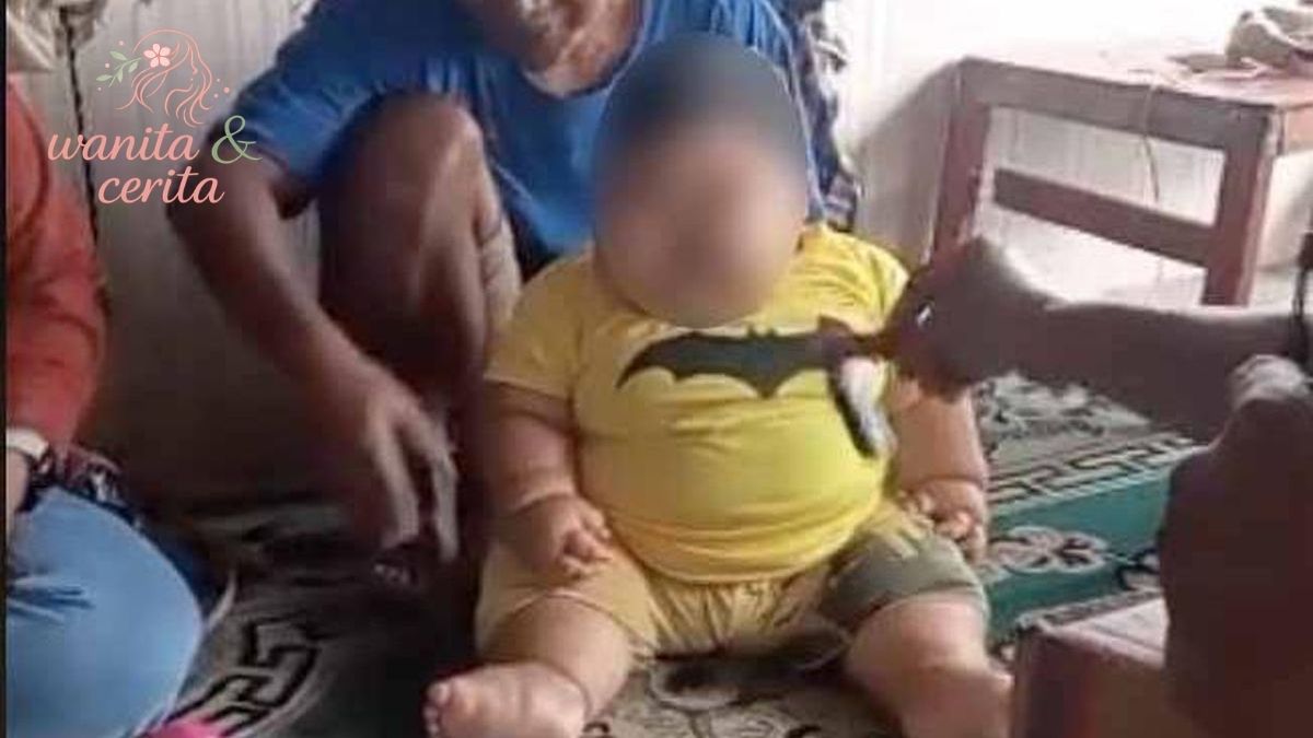 bayi obesitas berusia 1 tahun yang berbobot 25 kilogram